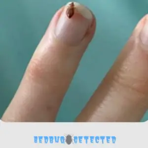 bedbug on a nail