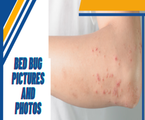 BED BUG PICTURES AND PHOTOS