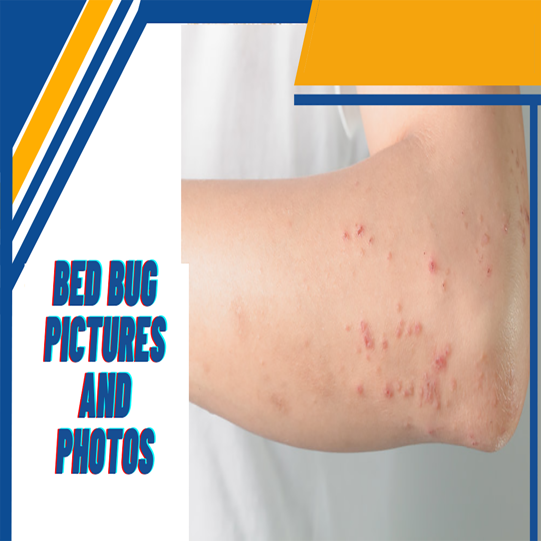 BED BUG PICTURES AND PHOTOS