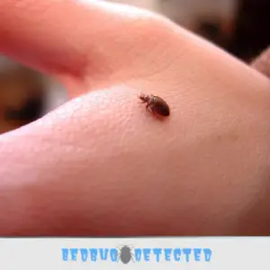 bedbugs on legs