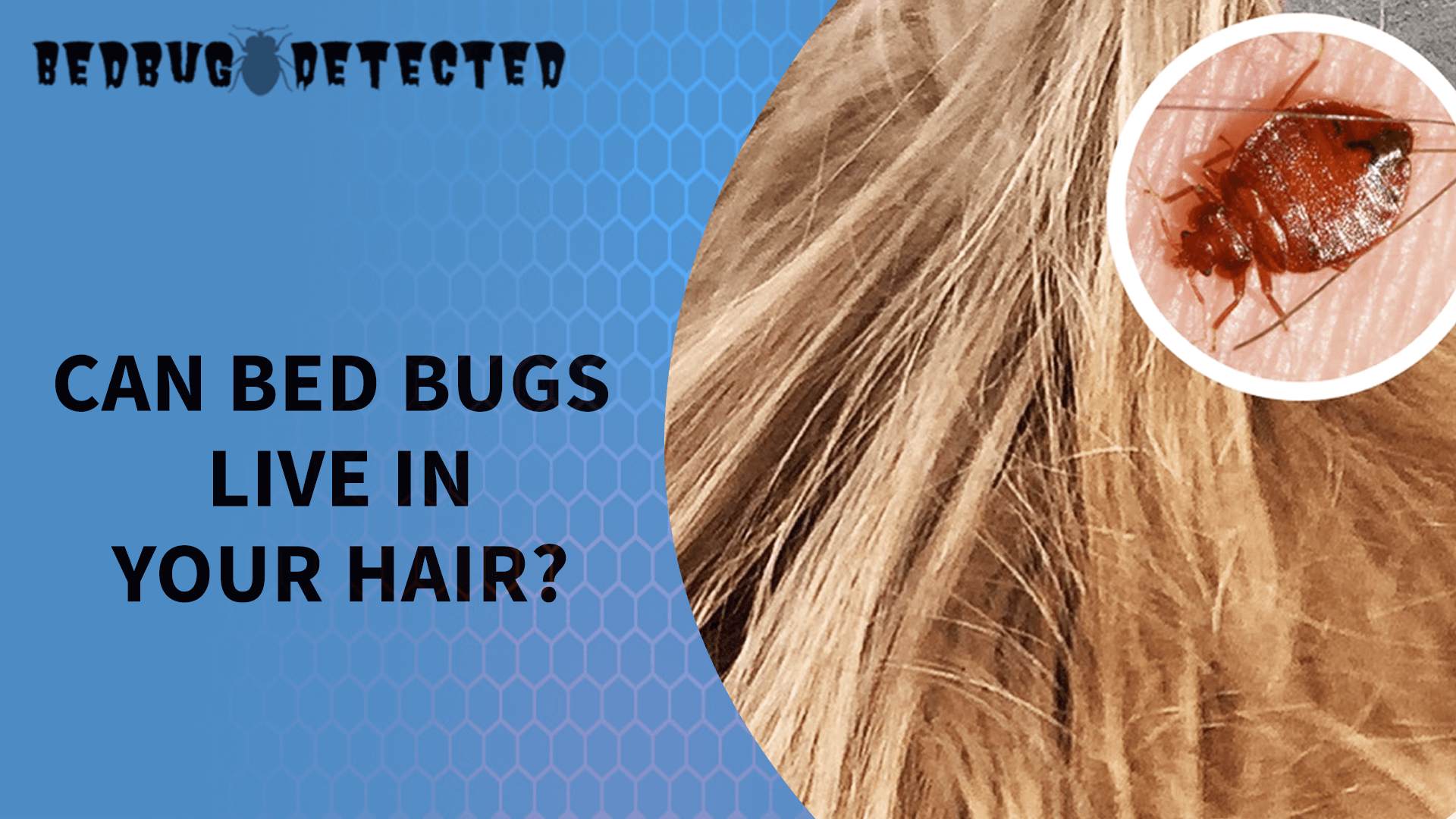 CAN BED BUGS LIVE IN YOUR HAIR (1)