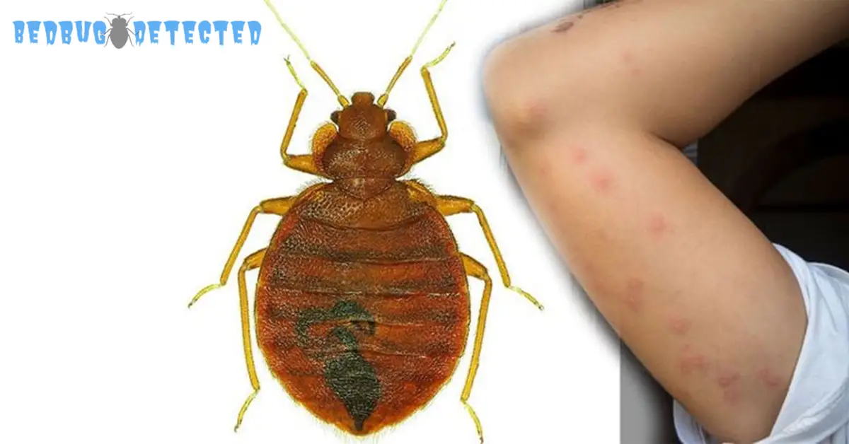Natural remedies for bed bugs